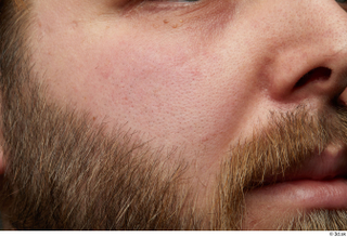  HD Face Skin Robert Watson cheek face nose skin pores skin texture wrinkles 0002.jpg